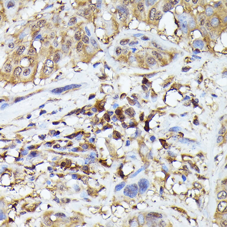 Immunohistochemistry - Anti-TMS1/ASC Antibody (A88925) - Antibodies.com