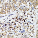 Immunohistochemistry - Anti-TMS1/ASC Antibody (A88925) - Antibodies.com