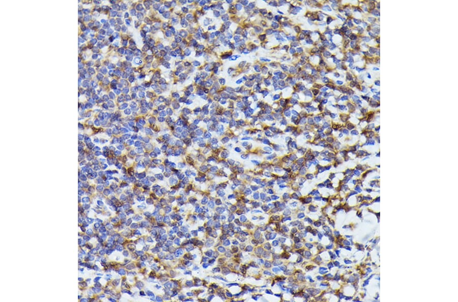 Immunohistochemistry - Anti-TMS1/ASC Antibody (A88925) - Antibodies.com