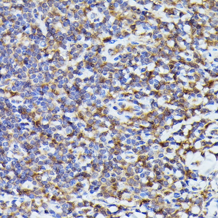 Immunohistochemistry - Anti-TMS1/ASC Antibody (A88925) - Antibodies.com