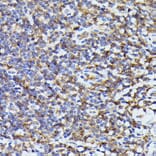 Immunohistochemistry - Anti-TMS1/ASC Antibody (A88925) - Antibodies.com