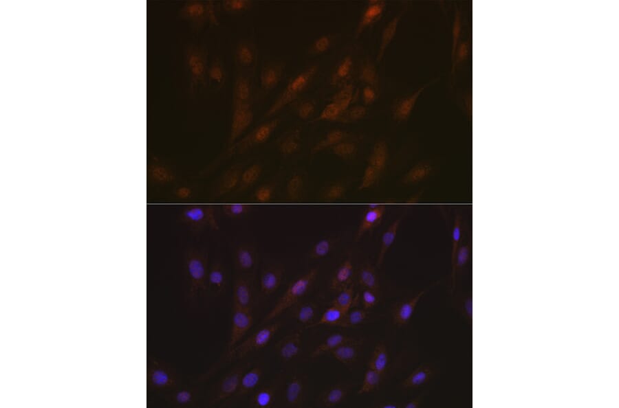 Immunofluorescence - Anti-TMS1/ASC Antibody (A88925) - Antibodies.com