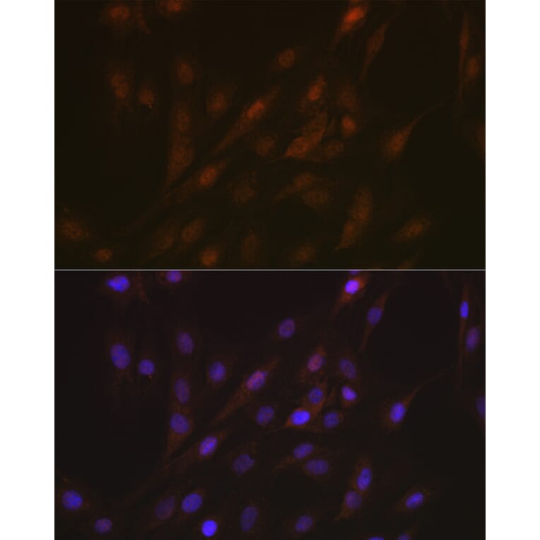 Immunofluorescence - Anti-TMS1/ASC Antibody (A88925) - Antibodies.com
