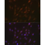 Immunofluorescence - Anti-TMS1/ASC Antibody (A88925) - Antibodies.com