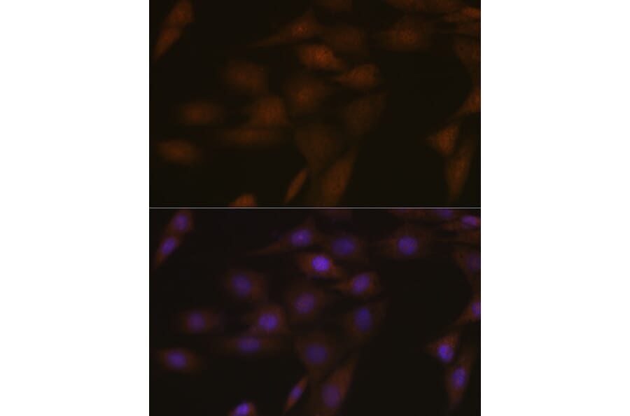 Immunofluorescence - Anti-TMS1/ASC Antibody (A88925) - Antibodies.com