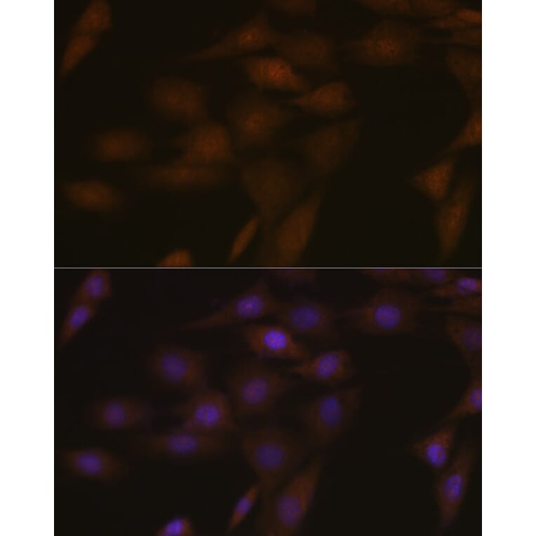 Immunofluorescence - Anti-TMS1/ASC Antibody (A88925) - Antibodies.com