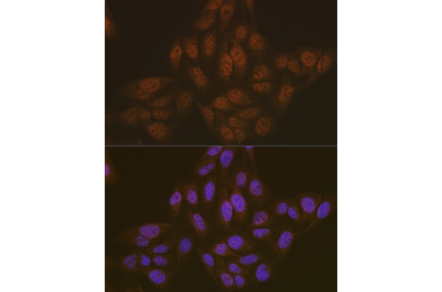 Immunofluorescence - Anti-TMS1/ASC Antibody (A88925) - Antibodies.com