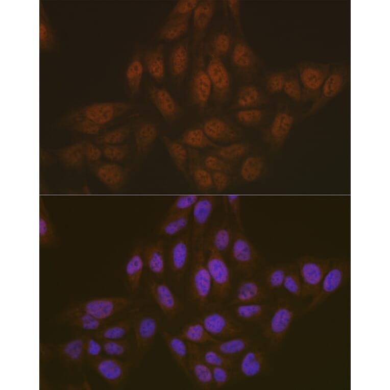 Immunofluorescence - Anti-TMS1/ASC Antibody (A88925) - Antibodies.com