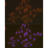 Immunofluorescence - Anti-TMS1/ASC Antibody (A88925) - Antibodies.com