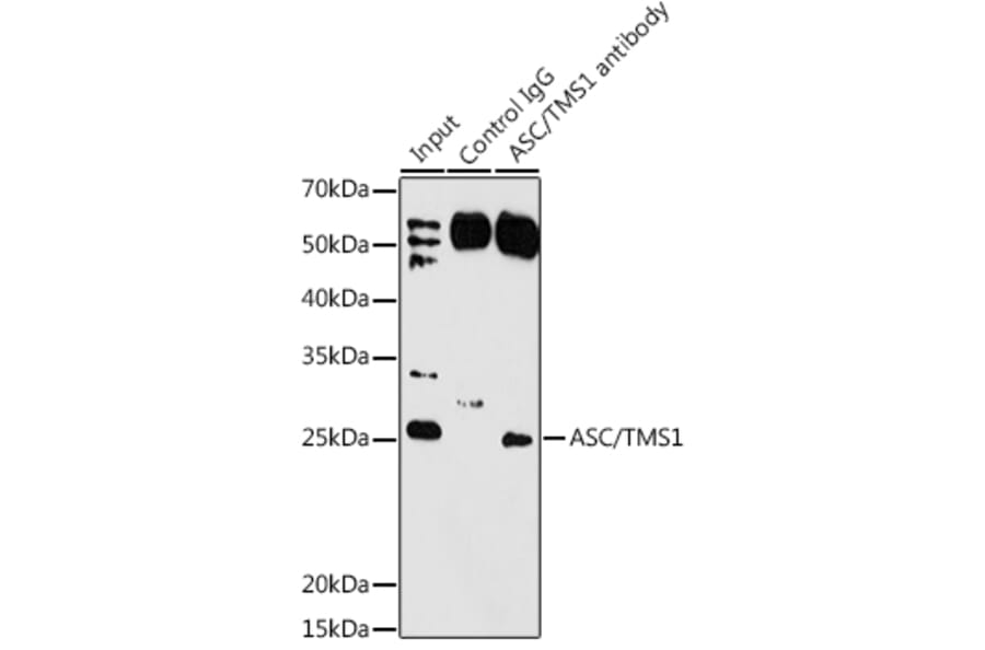 Western Blot - Anti-TMS1/ASC Antibody (A88925) - Antibodies.com