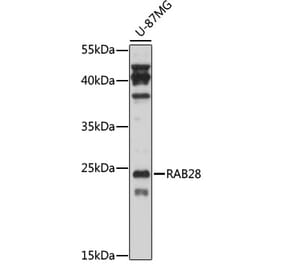 Western Blot - Anti-RAB28 Antibody (A88926) - Antibodies.com