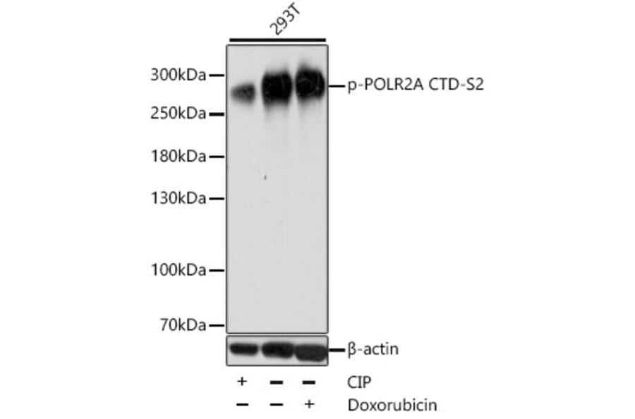 Western Blot - Anti-RNA polymerase II CTD repeat YSPTSPS (phospho Ser2) Antibody (A88927) - Antibodies.com