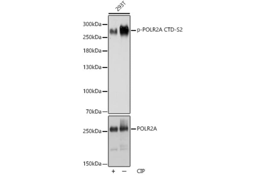 Western Blot - Anti-RNA polymerase II CTD repeat YSPTSPS (phospho Ser2) Antibody (A88927) - Antibodies.com