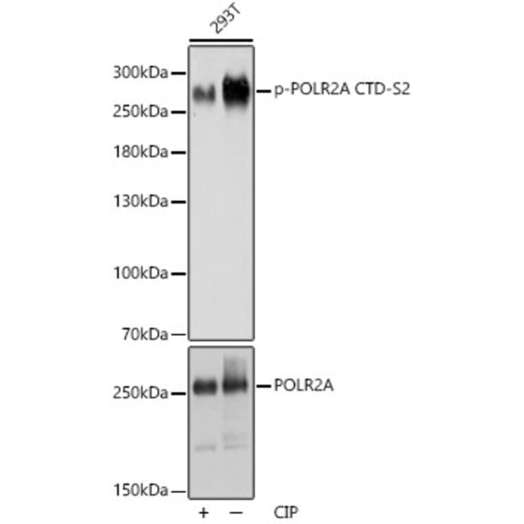 Western Blot - Anti-RNA polymerase II CTD repeat YSPTSPS (phospho Ser2) Antibody (A88927) - Antibodies.com