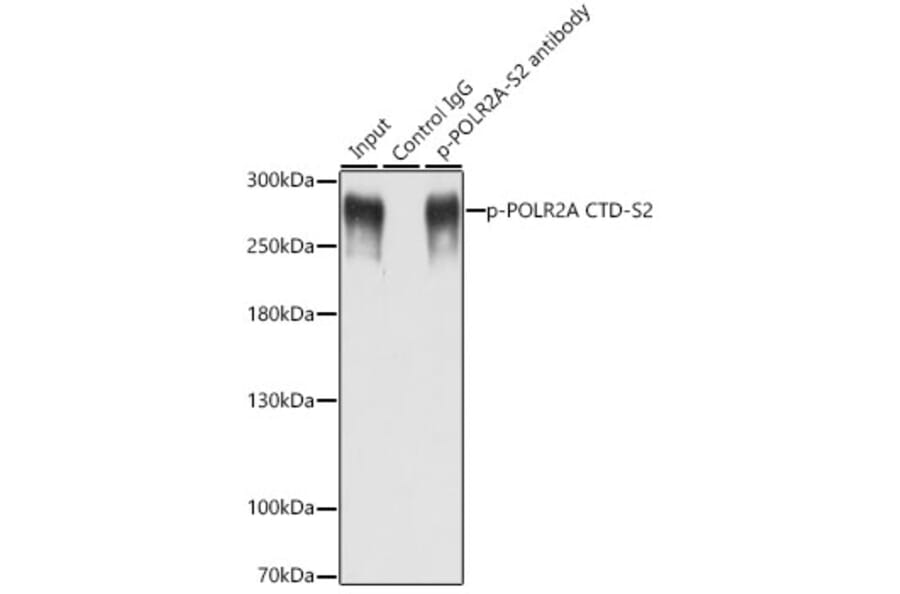Western Blot - Anti-RNA polymerase II CTD repeat YSPTSPS (phospho Ser2) Antibody (A88927) - Antibodies.com