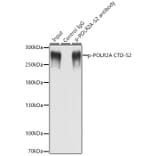 Western Blot - Anti-RNA polymerase II CTD repeat YSPTSPS (phospho Ser2) Antibody (A88927) - Antibodies.com
