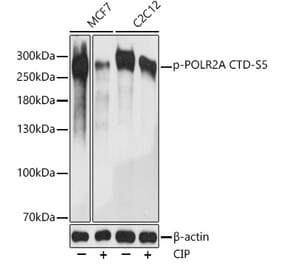 Western Blot - Anti-RNA polymerase II CTD repeat YSPTSPS (phospho Ser5) Antibody (A88928) - Antibodies.com