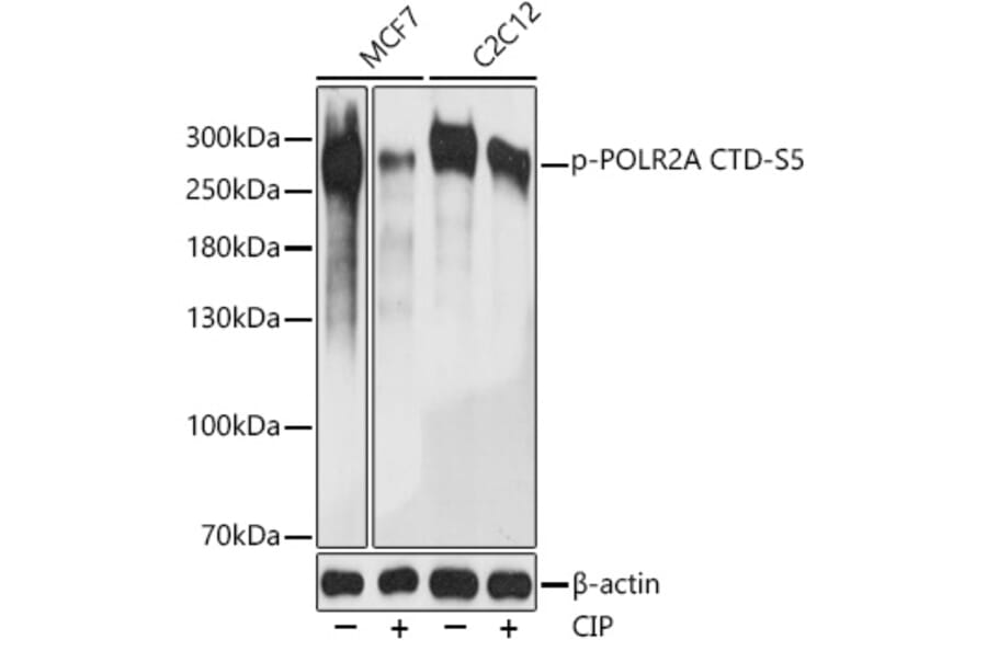 Western Blot - Anti-RNA polymerase II CTD repeat YSPTSPS (phospho Ser5) Antibody (A88928) - Antibodies.com
