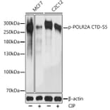 Western Blot - Anti-RNA polymerase II CTD repeat YSPTSPS (phospho Ser5) Antibody (A88928) - Antibodies.com