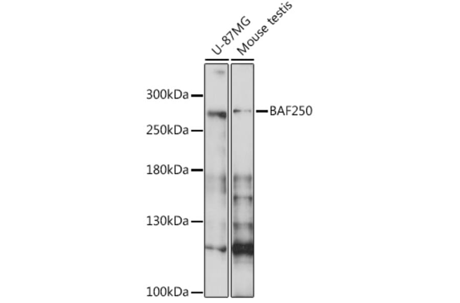 Western Blot - Anti-BAF250 Antibody (A16648) - Antibodies.com