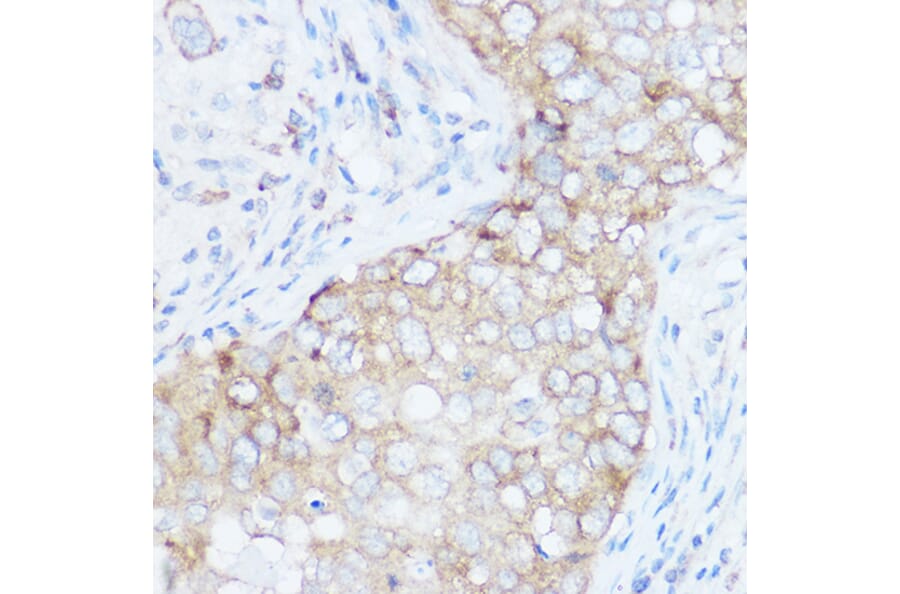 Immunohistochemistry - Anti-eIF4G1 Antibody (A88930) - Antibodies.com
