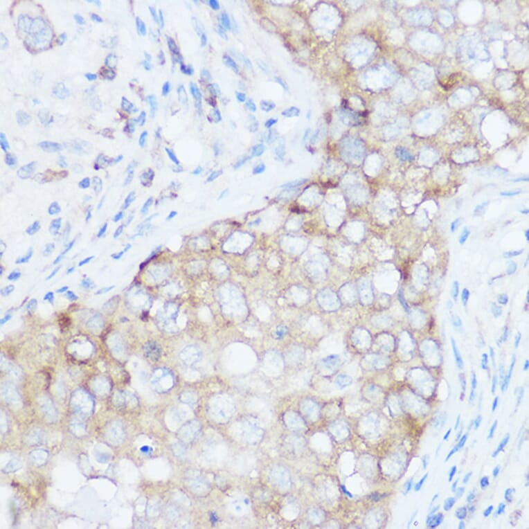 Immunohistochemistry - Anti-eIF4G1 Antibody (A88930) - Antibodies.com