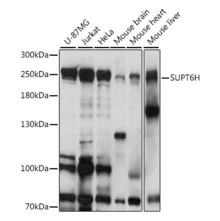 Western Blot - Anti-Spt6 Antibody (A88931) - Antibodies.com
