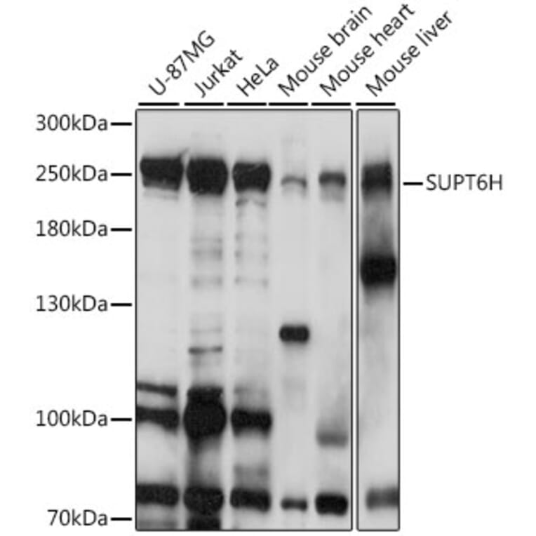 Western Blot - Anti-Spt6 Antibody (A88931) - Antibodies.com