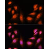 Immunofluorescence - Anti-Spt6 Antibody (A88931) - Antibodies.com