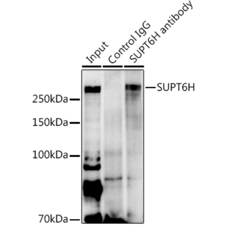 Western Blot - Anti-Spt6 Antibody (A88931) - Antibodies.com