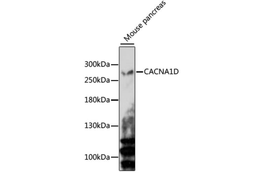 Western Blot - Anti-CACNA1D Antibody (A15034) - Antibodies.com
