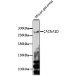Western Blot - Anti-CACNA1D Antibody (A15034) - Antibodies.com
