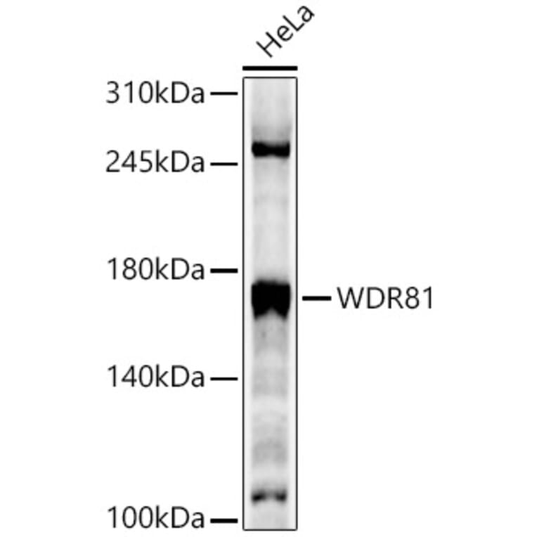 Western Blot - Anti-WDR81 Antibody (A88934) - Antibodies.com
