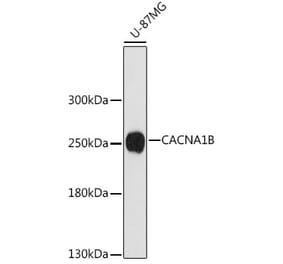 Western Blot - Anti-BIII Antibody (A88935) - Antibodies.com