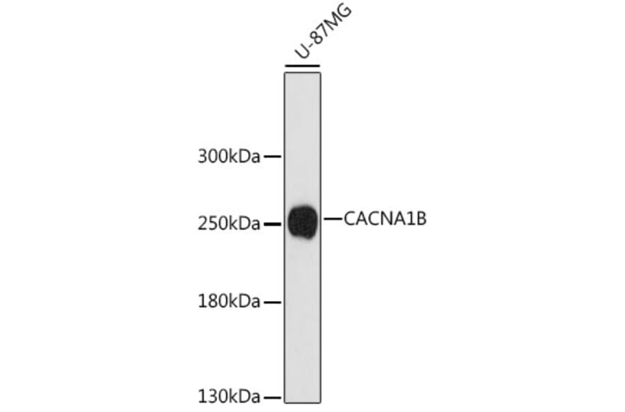 Western Blot - Anti-BIII Antibody (A88935) - Antibodies.com