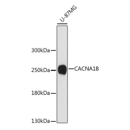 Western Blot - Anti-BIII Antibody (A88935) - Antibodies.com