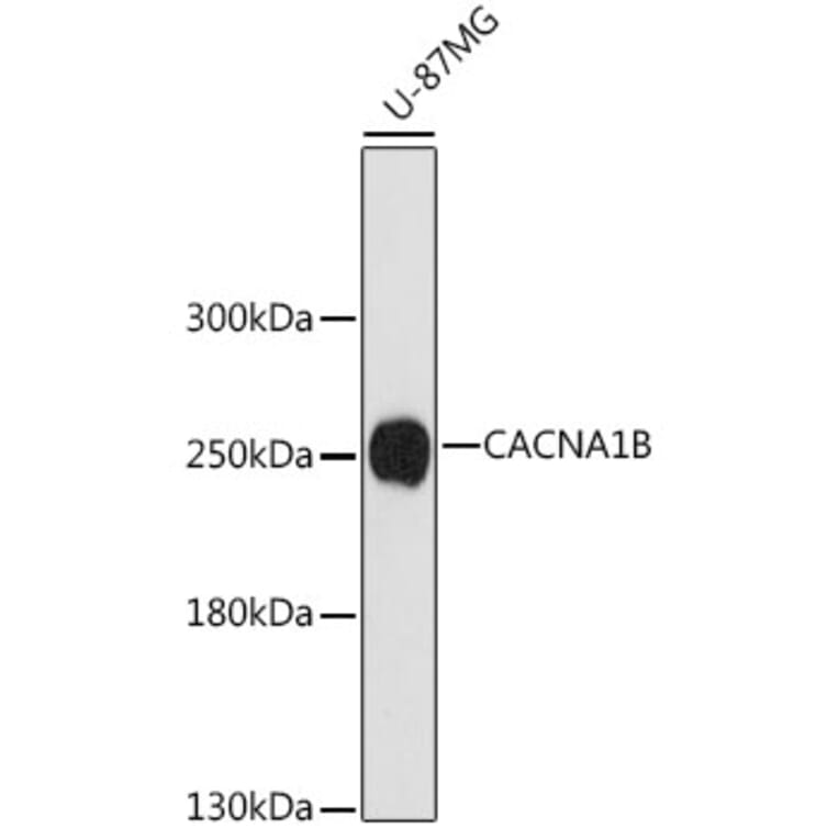 Western Blot - Anti-BIII Antibody (A88935) - Antibodies.com