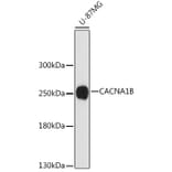 Western Blot - Anti-BIII Antibody (A88935) - Antibodies.com