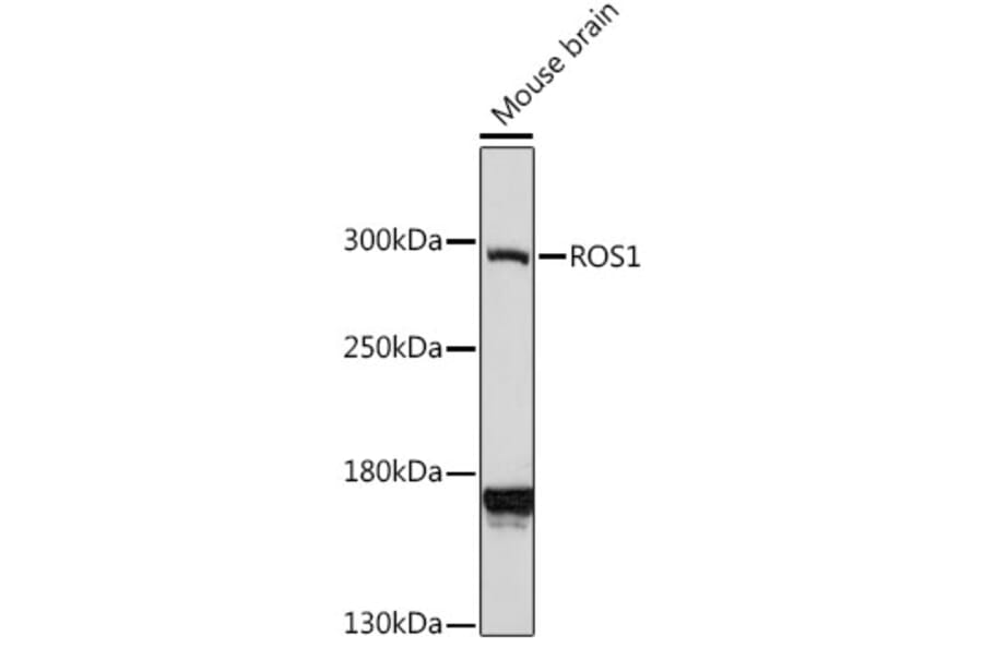 Western Blot - Anti-ROS1 Antibody (A88936) - Antibodies.com