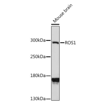 Western Blot - Anti-ROS1 Antibody (A88936) - Antibodies.com