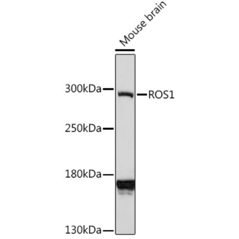 Western Blot - Anti-ROS1 Antibody (A88936) - Antibodies.com