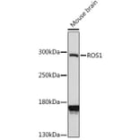 Western Blot - Anti-ROS1 Antibody (A88936) - Antibodies.com