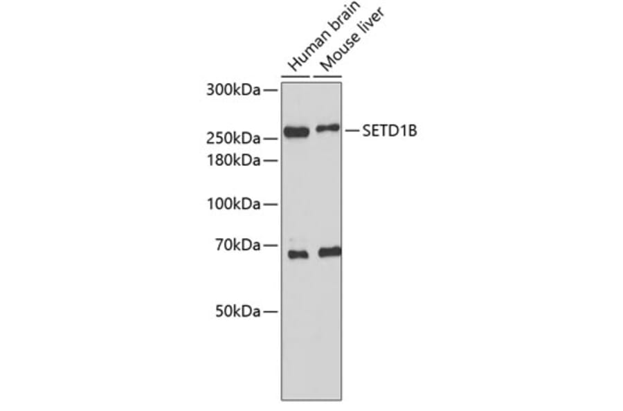 Western Blot - Anti-SETD1B Antibody (A2300) - Antibodies.com