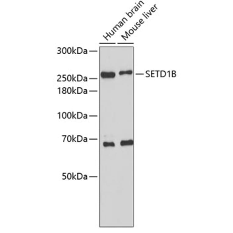 Western Blot - Anti-SETD1B Antibody (A2300) - Antibodies.com