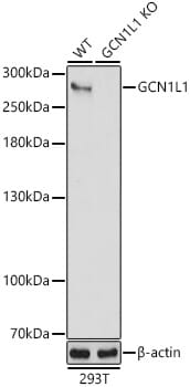 Western blot analysis of extracts of various cell lines, using Anti-GCN1L1 Antibody (A13075) at 1:3000 dilution.
Secondary antibody: Goat Anti-Rabbit IgG (H+L) (HRP) (AS014) at 1:10,000 dilution.
Lysates / proteins: 25µg per lane.
Blocking buffer: 3% non-fat dry milk in TBST.
Detection: ECL Basic Kit (RM00020).
Exposure time: 30s.
