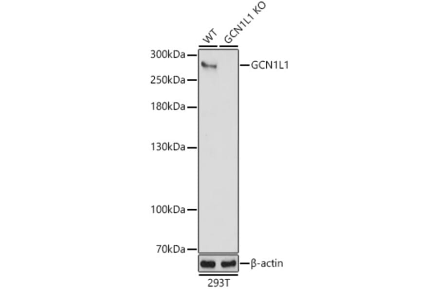Western Blot - Anti-GCN1 Antibody (A88938) - Antibodies.com