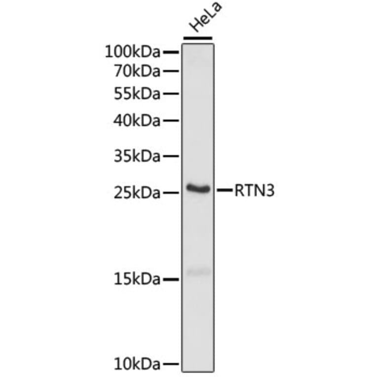 Western Blot - Anti-RTN3/HAP Antibody (A88939) - Antibodies.com