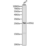 Western Blot - Anti-RTN3/HAP Antibody (A88939) - Antibodies.com