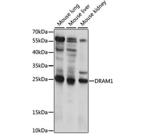 Western Blot - Anti-DRAM Antibody (A88940) - Antibodies.com