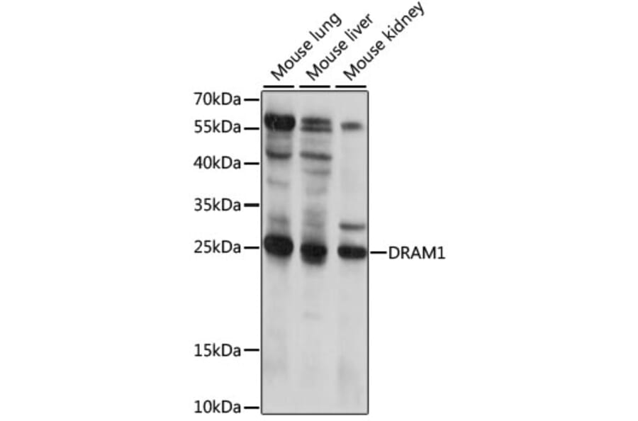 Western Blot - Anti-DRAM Antibody (A88940) - Antibodies.com